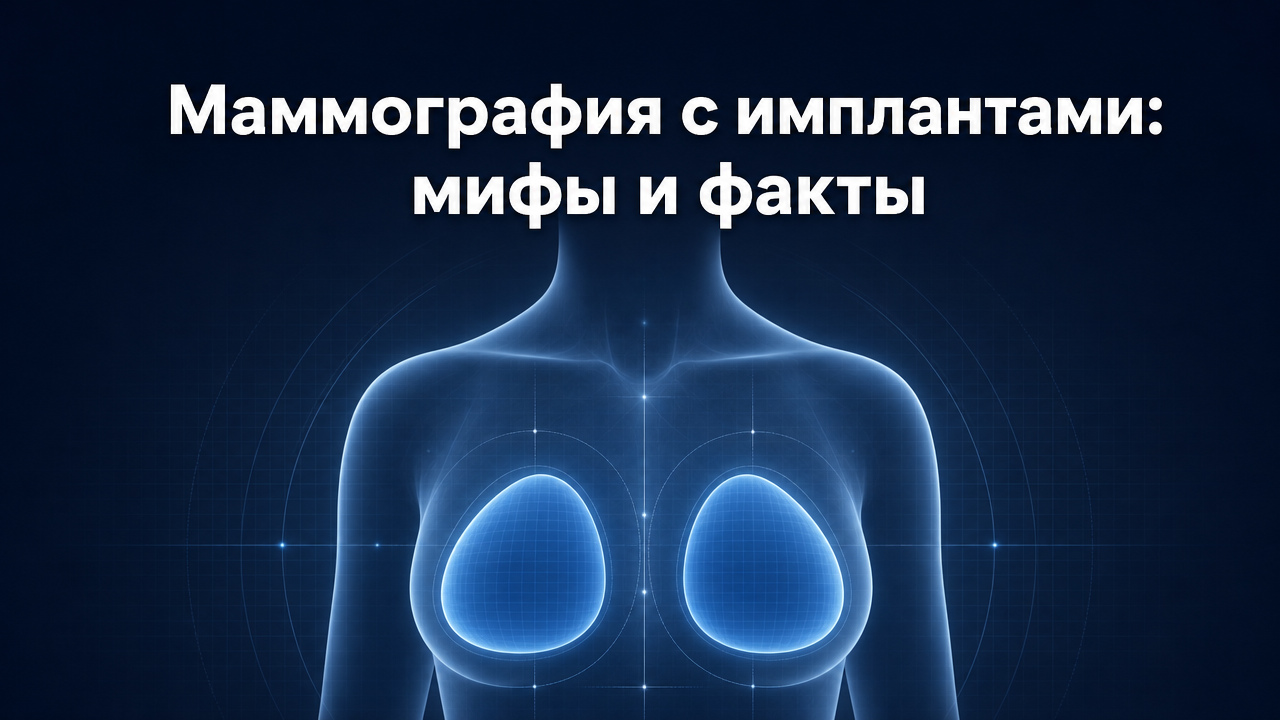 Увеличение груди и маммография: как импланты влияют на обследование